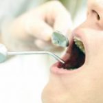 「虫歯・歯槽膿漏」口腔内の血行が悪いのが原因
