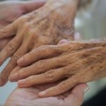 「たるみ・シミ・しわ」美肌の条件は「きれいな血液がスムーズに流れていること
